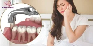 Nha Khoa Vnes – Công Ty TNHH Vnes