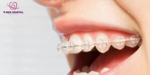 Nha Khoa Vnes – Công Ty TNHH Vnes